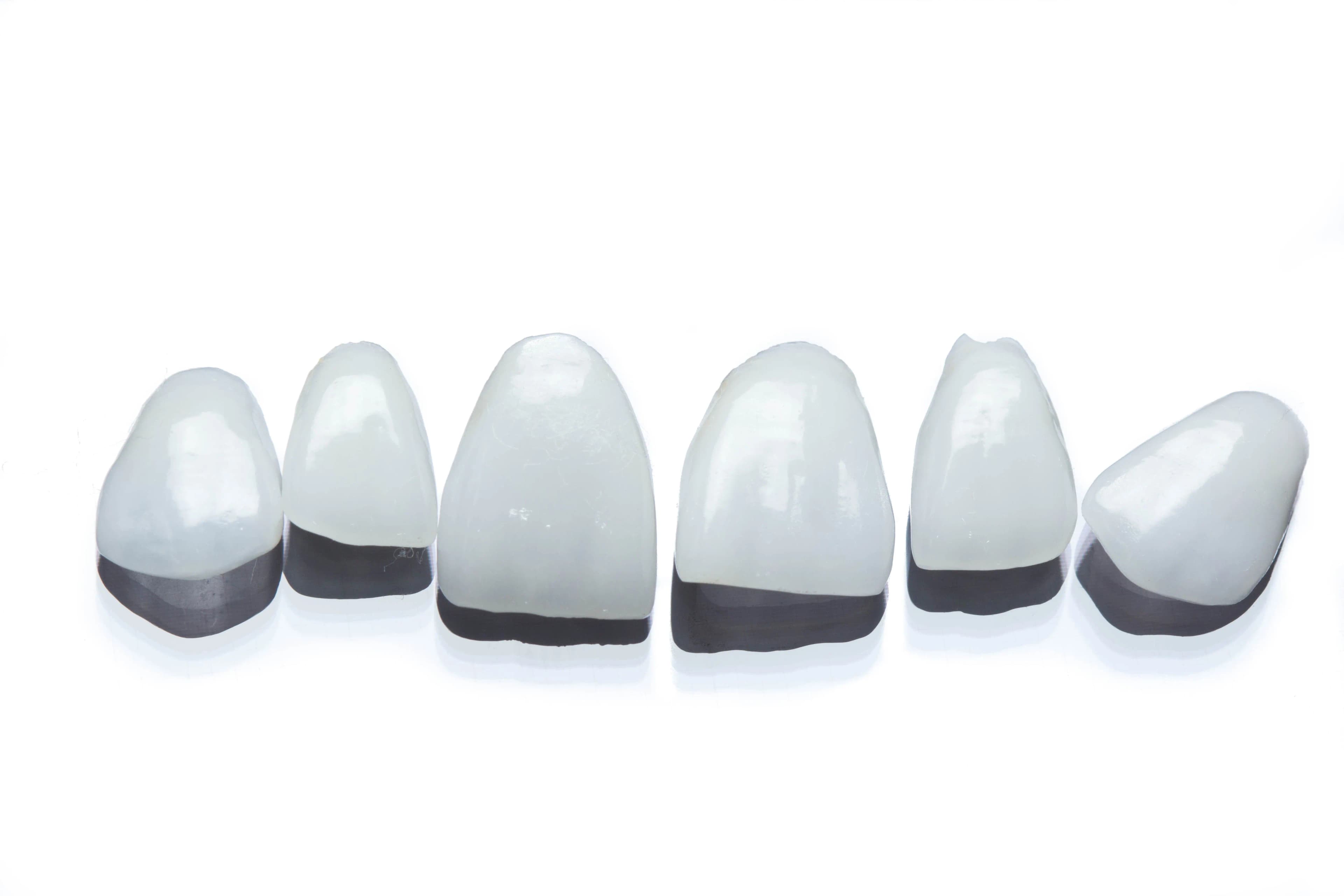 Lentes de contacto dental resultado — AM Estética Dental Buenos Aires