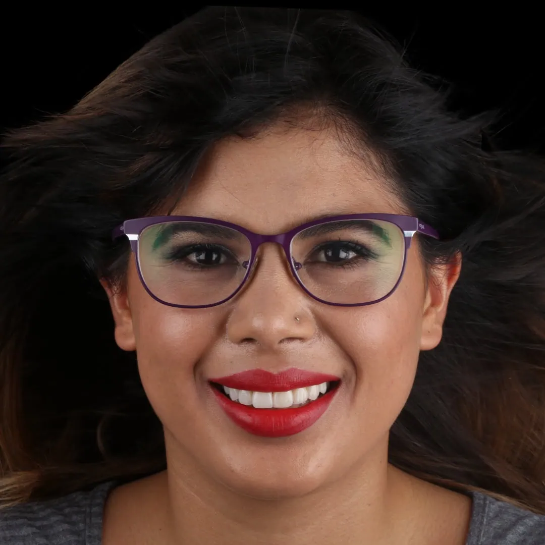 Caso Eli — después del tratamiento con carillas cerámicas — AM Estética Dental